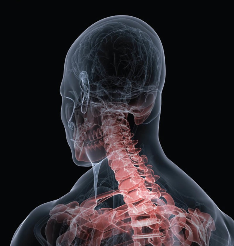 An x - ray of a man's neck.